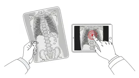 Navigating AI Hopes and Fears in Radiology
