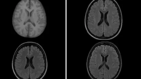 Adaptive-CGAN Improves Accuracy for Synthetic Medical Imaging